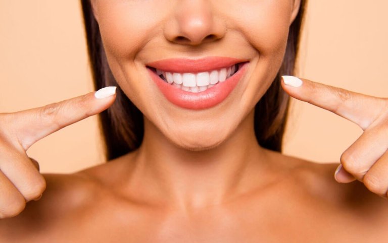 Unlock Your Best Smile: The Ultimate Guide to Veneers in Las Vegas